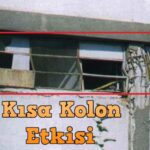kısa kolon nedir